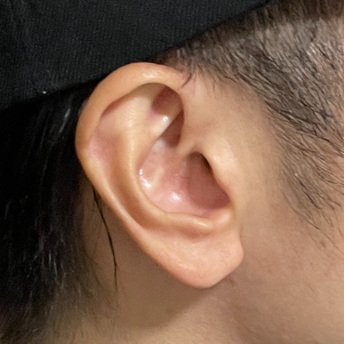 AirPods（第3世代）が落ちやすい耳の形状